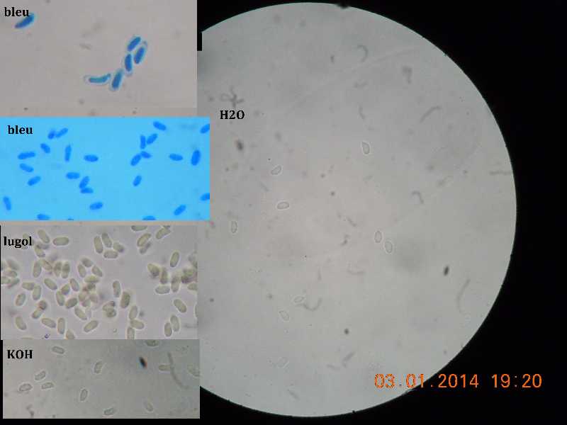 sistotrema (Sistotrema coroniferum)
